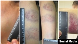 Болот Темиров Фейсбуктагы баракчасына жарыялаган сүрөттөр. 