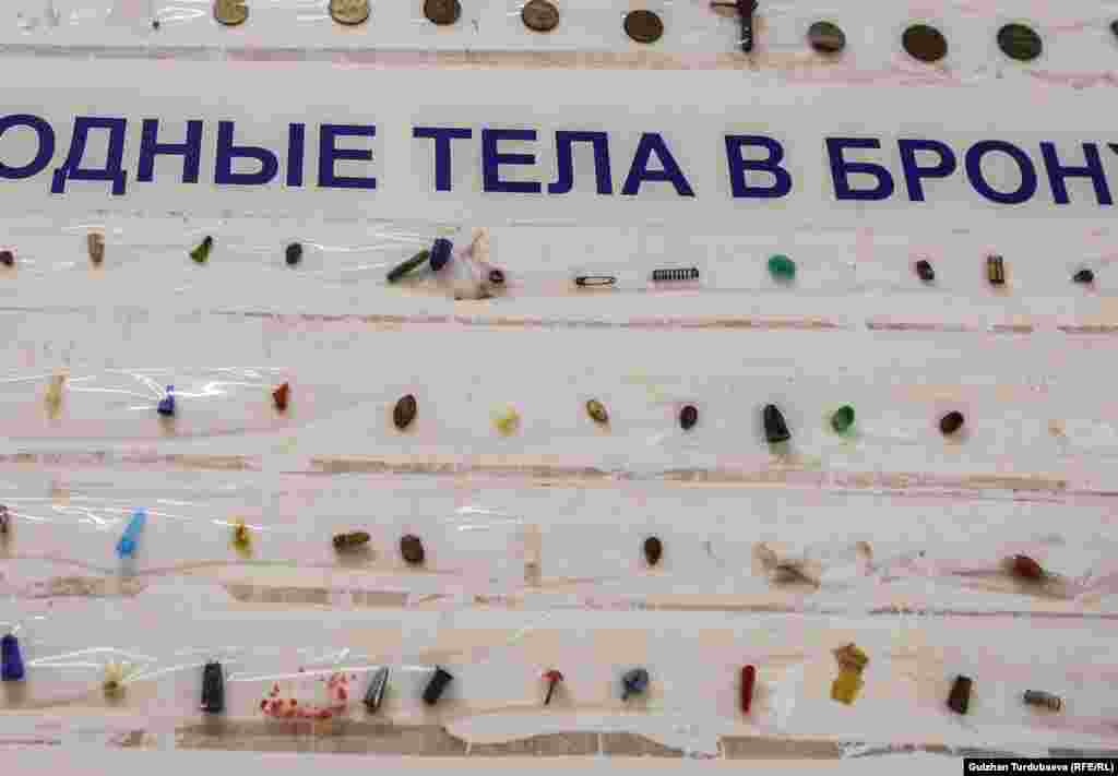 Мелкие предметы извлекают из желудка и даже бронхов.&nbsp; &nbsp;