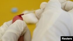 Иллюстративное фото