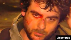 Один из пострадавших