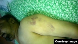 Илҳом Ибодовнинг қамоқдан юборилган жасади.