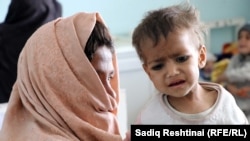 ارشیف، کندهار کې یو خوارځواکه ماشوم