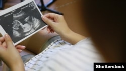 Până acum, femeile care continuau să lucreze în perioada concediului de maternitate erau lipsite de indemnizație sau, dacă o luau, acceptau să primească salariul în plic.