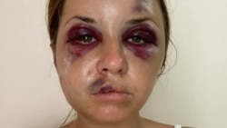 Анастасія Лугова