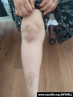 Дильдора Ходжакулова утверждает, что была избита сотрудниками Нацгвардии и ОВД Яккабагского района.