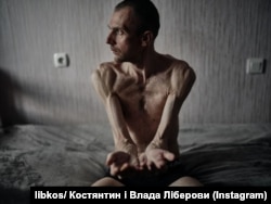 Украинский военный после российского плена