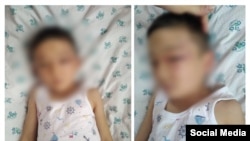 Избитый мальчик.