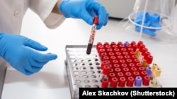 Иллюстративное фото. 