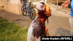 Пацярпелы падчас пратэстаў 10 жніўня 2020