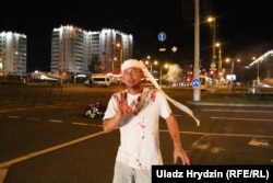 Ранен протестиращ по улиците на Минск на 10 август. Силите за сигурност използваха звукови гранати и гумени куршуми срещу демонстрантите. Някои от тях бяха и бити.