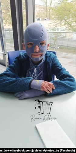 Roman Oleksiv a purtat o mască compresivă pe cap și față timp de doi ani, după atacul care l-a lăsat cu arsuri grave.
