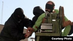 ირანელი მსჯავრდებული, რომელსაც თითების ამპუტაცია აქვს მისჯილი.