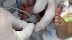 پېښور کې د مور او پلار په نه شتون کې افغان ماشوم له درملنې محروم دی