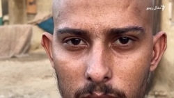 پاکستان کې مېشت ناروغه افغان کډوال له مشکل سره مخ شوي