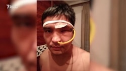 "Көзүмдөн айрылдым. Кайнак суу куюп, жаагымды сындырышты".  