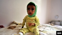Йемендик бала. 2-июнь, 2012-жыл.