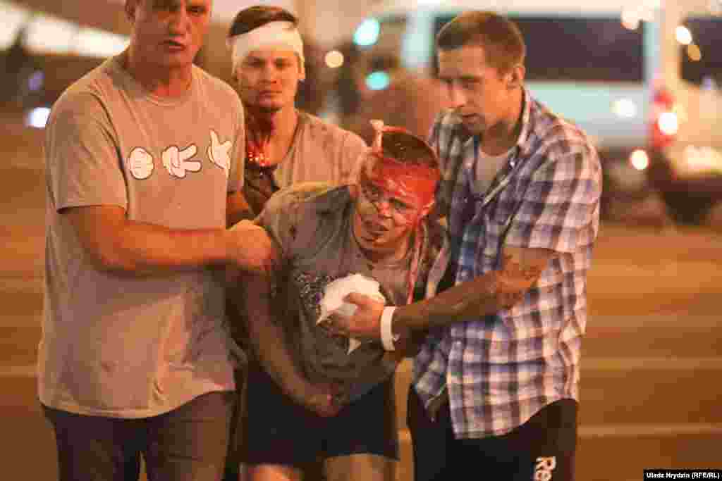 На повреден човек му е укажана помош во Минск. Полицијата испукала гумени куршуми, шок гранати и солзавец кон демонстрантите кои го обвинуваат претседателот Лукашенко за фалсификување на резултатите од изборите во земјата на 9 август.