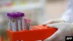 Иллюстрация үчүн колдонулган сүрөт.