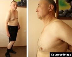 Ибрагим Дехканбаев показывает шрамы от пыток.